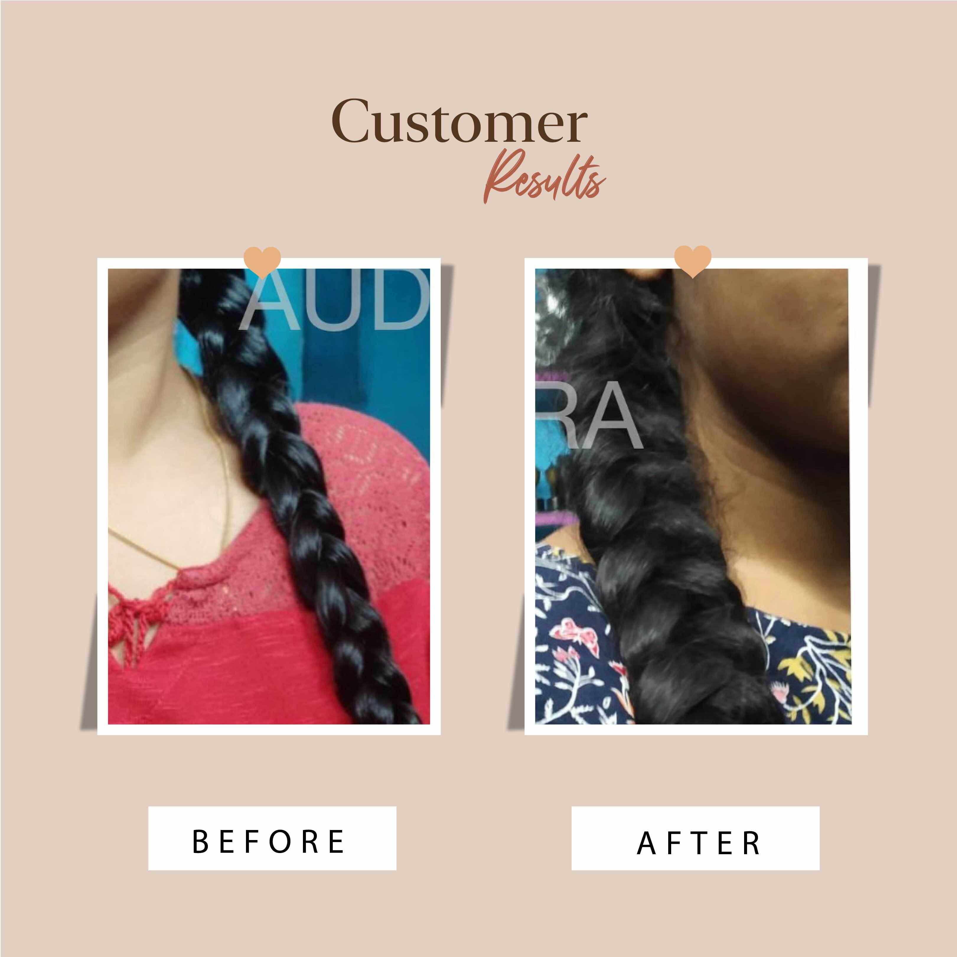 Hair Fall Control Kit - Oil + Shampoo