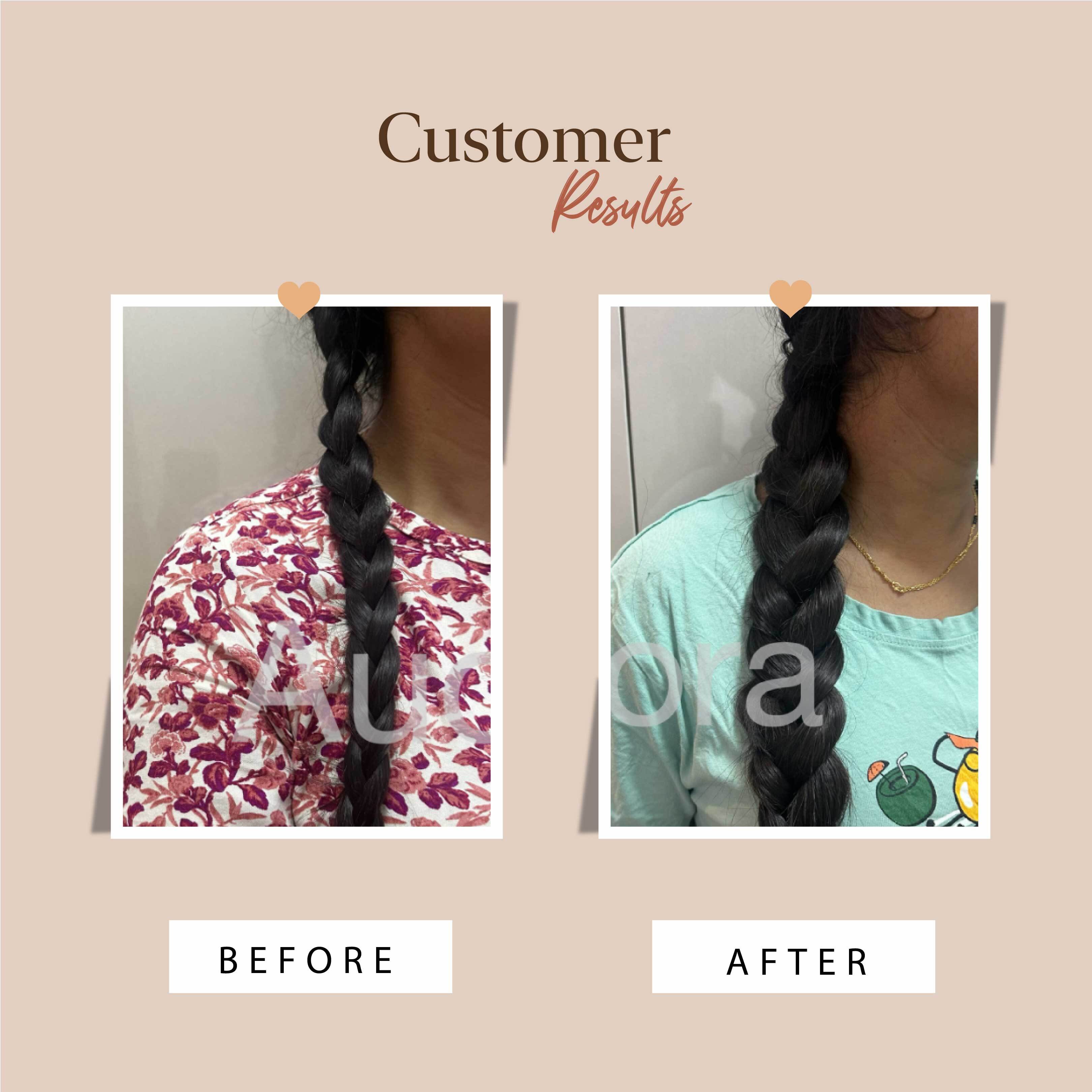 Hair Fall Control Kit - Oil + Shampoo